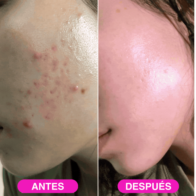 Tu rostro atraera miradas - avel rois