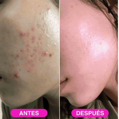 Tu rostro atraera miradas - avel rois